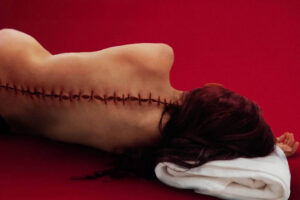 O corpo da Elisabeth deitado com a cabeça em uma toalha dobrada. A coluna dorsal exibe um corte costurado com linha groça em toda a estensao da costas.