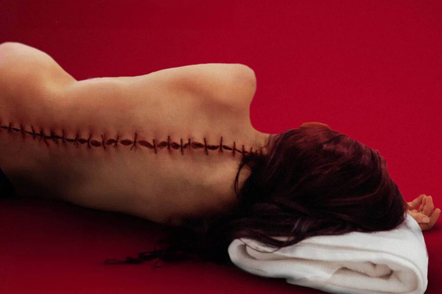 O corpo da Elisabeth deitado com a cabeça em uma toalha dobrada. A coluna dorsal exibe um corte costurado com linha groça em toda a estensao da costas.